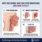 Why you snore — diagram of the airway, and how RestWell EMS tightens the throat muscles - Thumbnail 2
